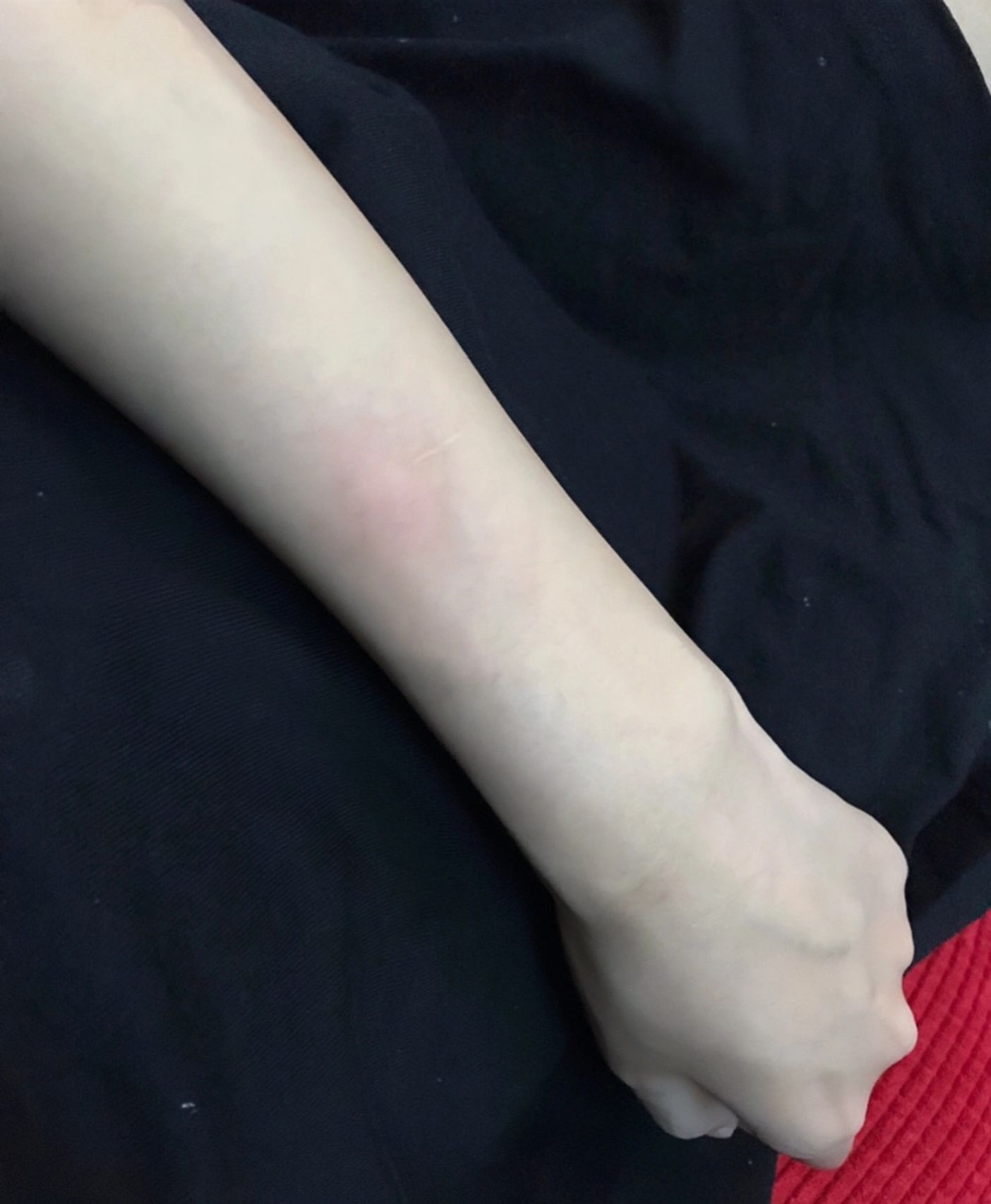 手手控日常美白(每次被磕到撞到就直接红一块紫一块的)-喵神素材库