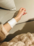 3受伤包扎手(受伤的小手医生说恢复要三个月)-喵神素材库